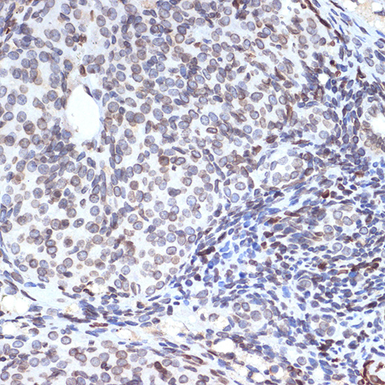 SUN2 Rabbit monoclonal antibody