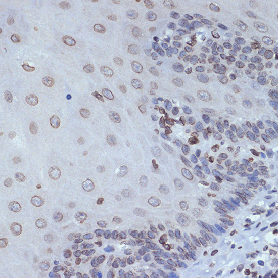 SUN2 Rabbit monoclonal antibody