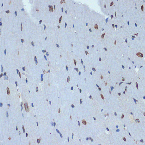 SUN2 Rabbit monoclonal antibody
