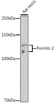 Pumilio 2 Rabbit monoclonal antibody