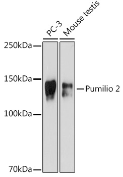 Pumilio 2 Rabbit monoclonal antibody