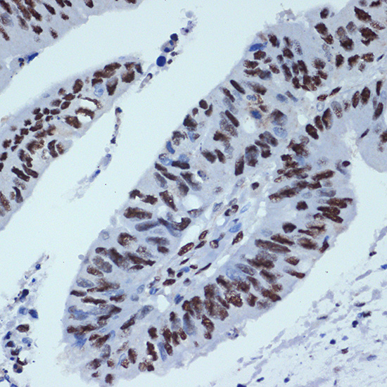 ZBTB7A/FBI-1/LRF Rabbit monoclonal antibody
