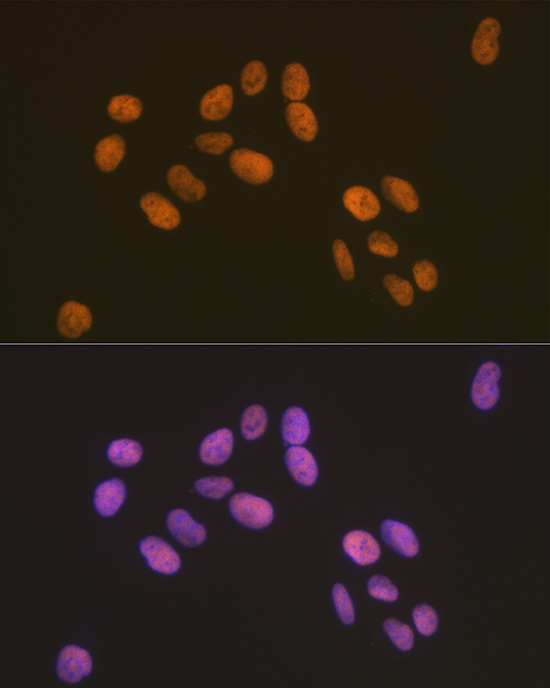 ZBTB7A/FBI-1/LRF Rabbit monoclonal antibody