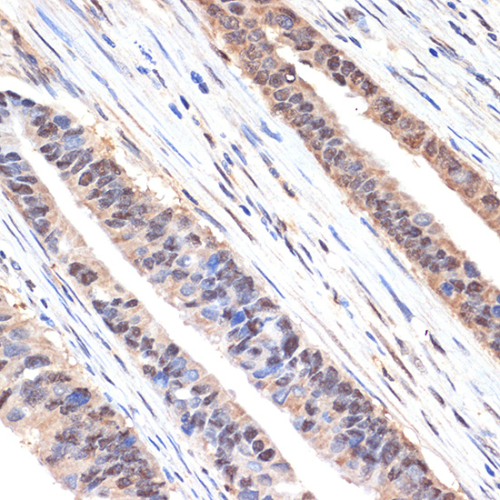 sestrin 1 Rabbit monoclonal antibody