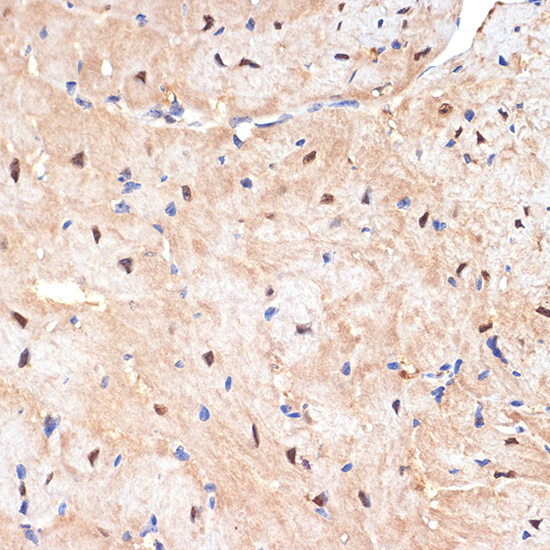 sestrin 1 Rabbit monoclonal antibody