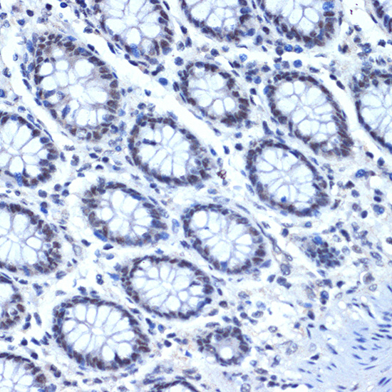 CDC40 Rabbit monoclonal antibody