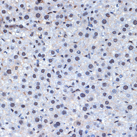 CDC40 Rabbit monoclonal antibody