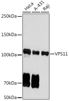 VPS11 Rabbit monoclonal antibody