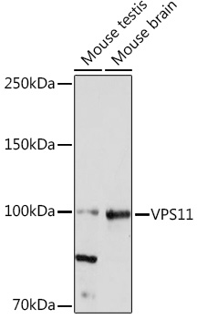 VPS11 Rabbit monoclonal antibody
