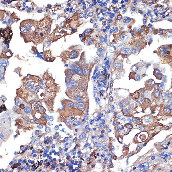 VPS11 Rabbit monoclonal antibody