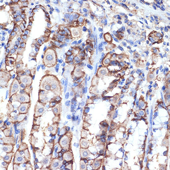 VPS11 Rabbit monoclonal antibody