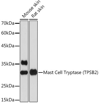 Mast Cell Tryptase (TPSB2) Rabbit monoclonal antibody