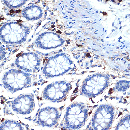 Mast Cell Tryptase (TPSB2) Rabbit monoclonal antibody