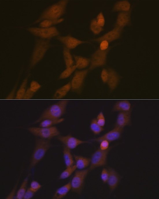 STK33 Rabbit monoclonal antibody