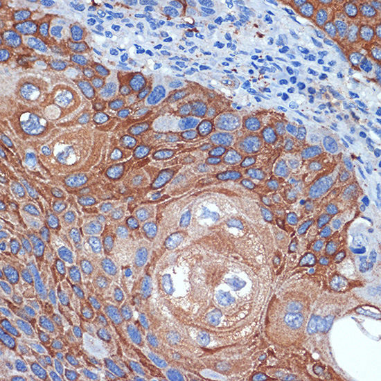 BCL2L12 Rabbit monoclonal antibody