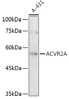ACVR2A Rabbit polyclonal antibody