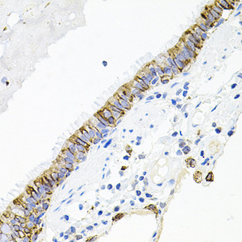 ACVR2A Rabbit polyclonal antibody