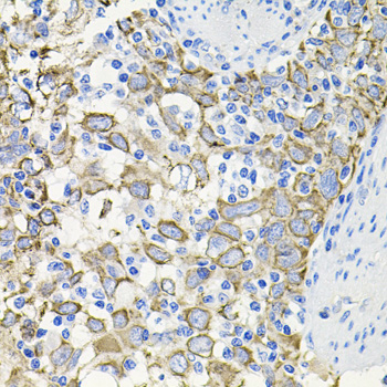 ACVR2A Rabbit polyclonal antibody