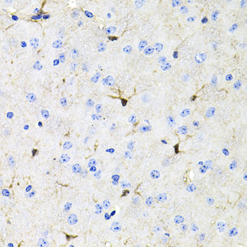 ACVR2A Rabbit polyclonal antibody