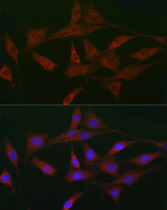 ACVR2A Rabbit polyclonal antibody