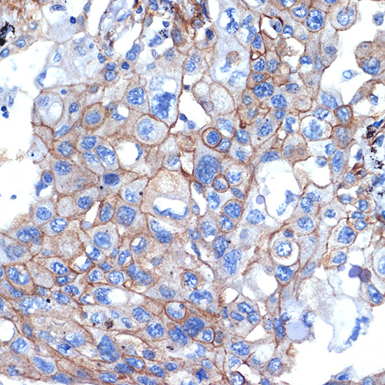 Talin 2 Rabbit monoclonal antibody