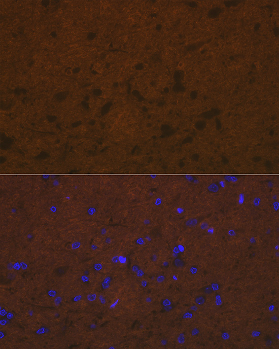 Talin 2 Rabbit monoclonal antibody