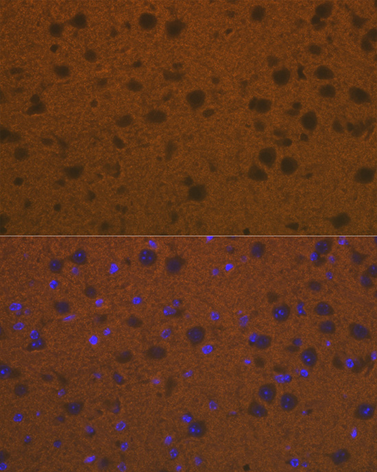 Talin 2 Rabbit monoclonal antibody