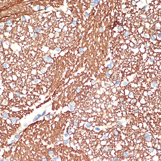 Syntaxin Rabbit monoclonal antibody