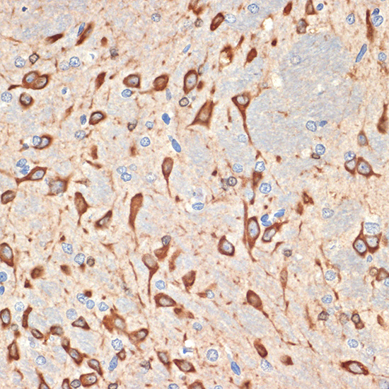Musashi-2 (MSI2) Rabbit monoclonal antibody