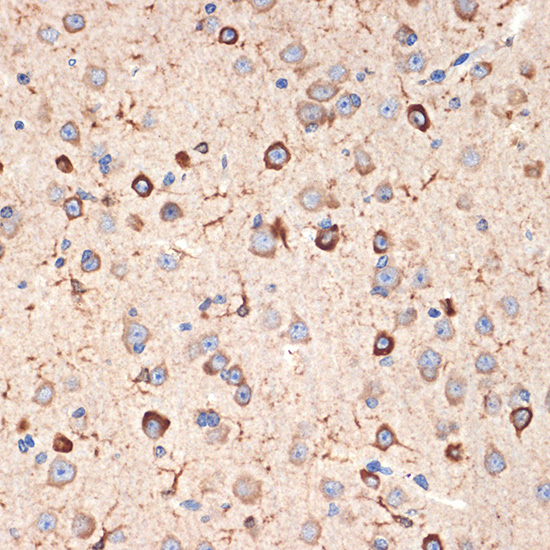 Musashi-2 (MSI2) Rabbit monoclonal antibody