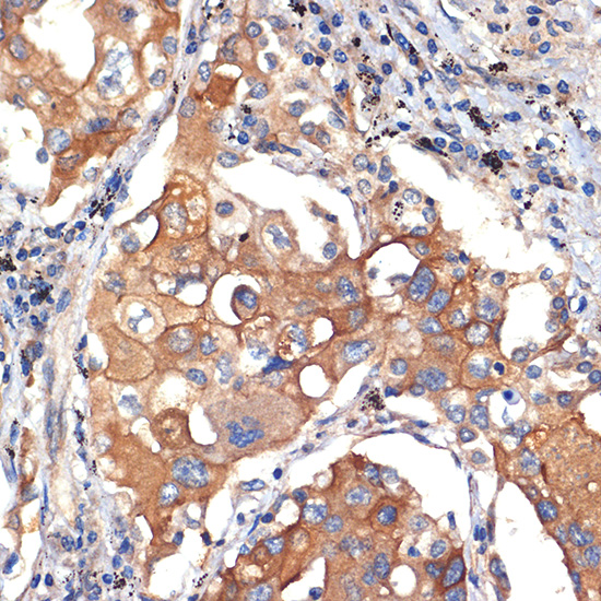 eIF2C3 Rabbit monoclonal antibody
