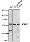Western blot - CYP27A1 Rabbit pAb (A1982)