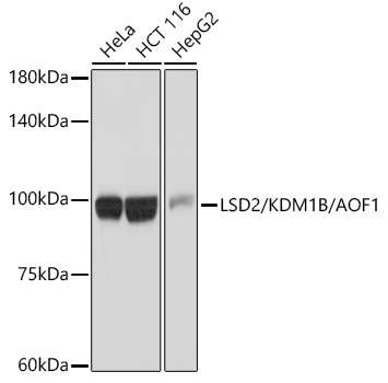 LSD2/KDM1B/AOF1 Rabbit monoclonal antibody