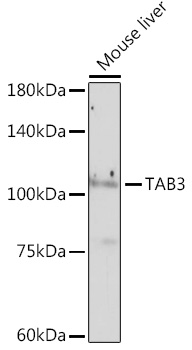TAB3 Rabbit monoclonal antibody