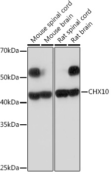 CHX10 Rabbit monoclonal antibody