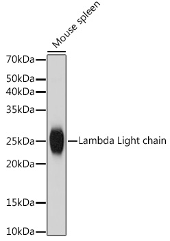 Lambda Light chain Rabbit monoclonal antibody