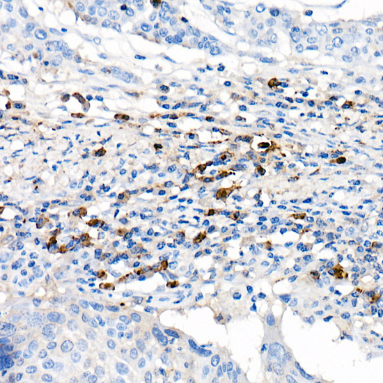 Lambda Light chain Rabbit monoclonal antibody