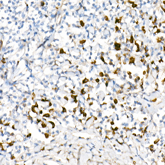 Lambda Light chain Rabbit monoclonal antibody