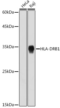 HLA-DRB1 Rabbit monoclonal antibody
