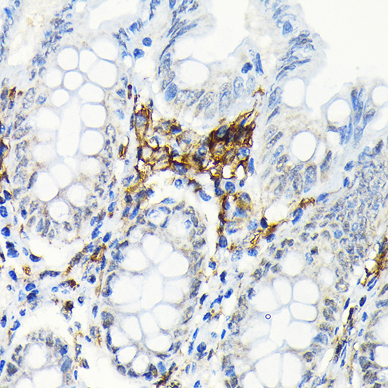 HLA-DRB1 Rabbit monoclonal antibody