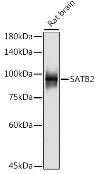 SATB2 Rabbit monoclonal antibody