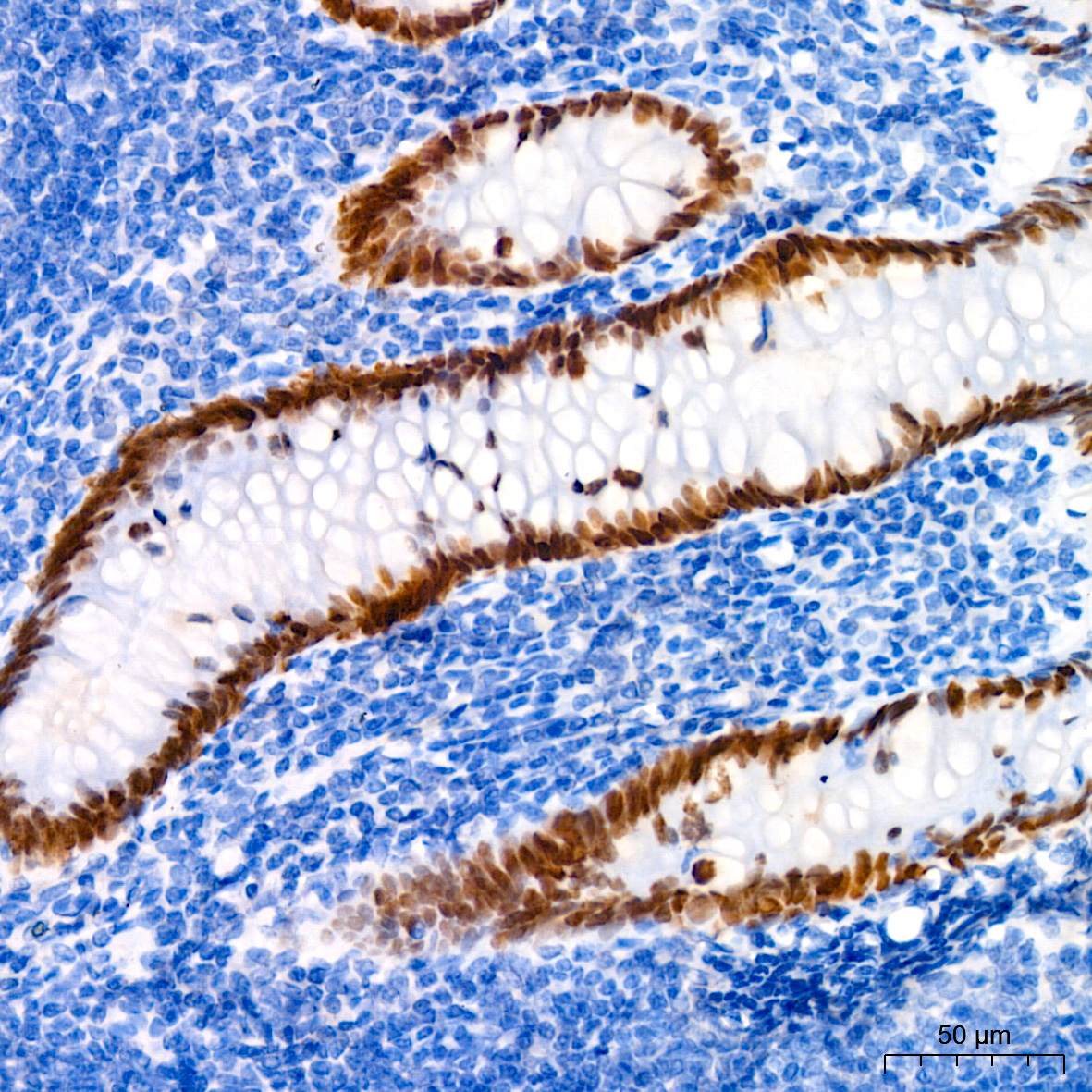 SATB2 Rabbit monoclonal antibody