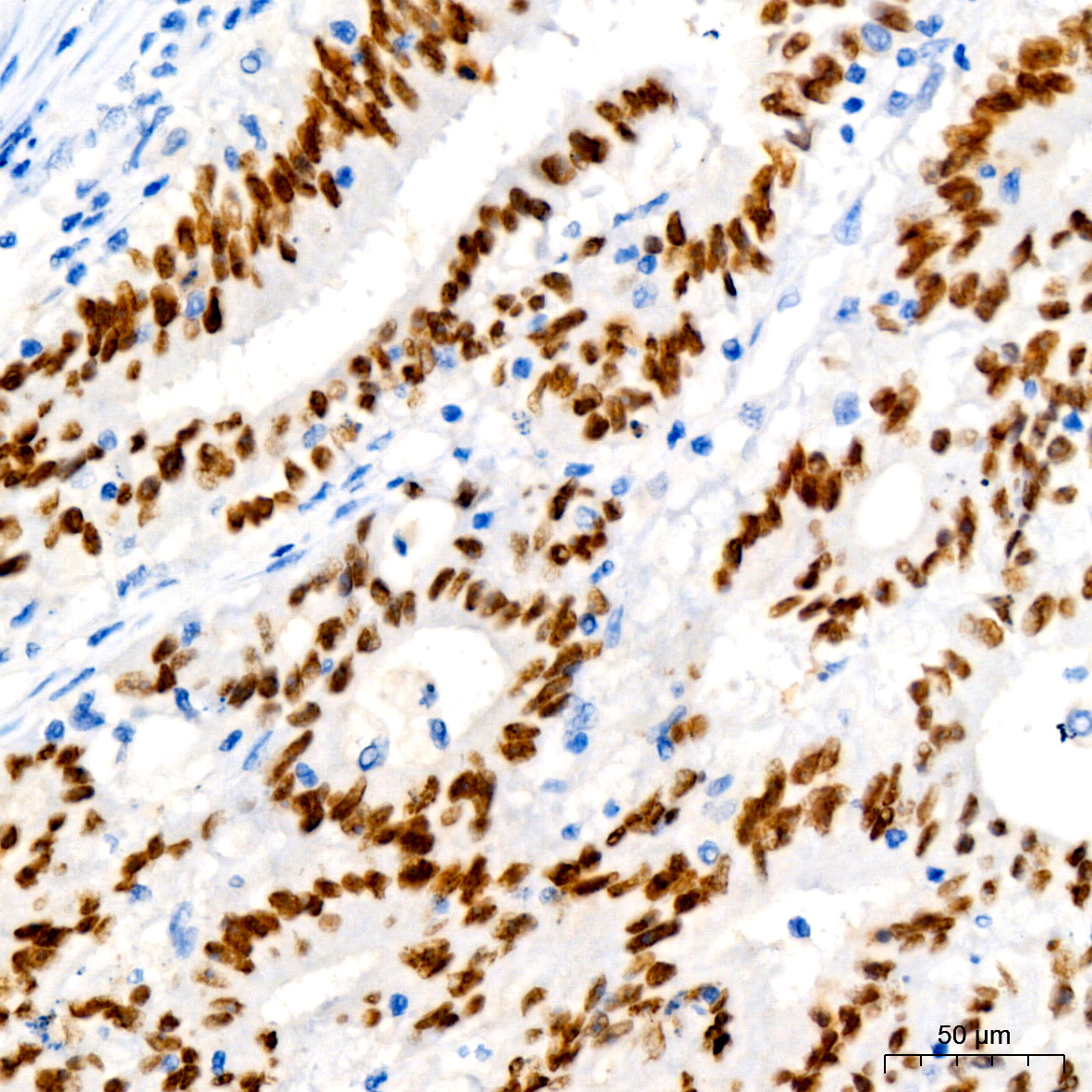 SATB2 Rabbit monoclonal antibody