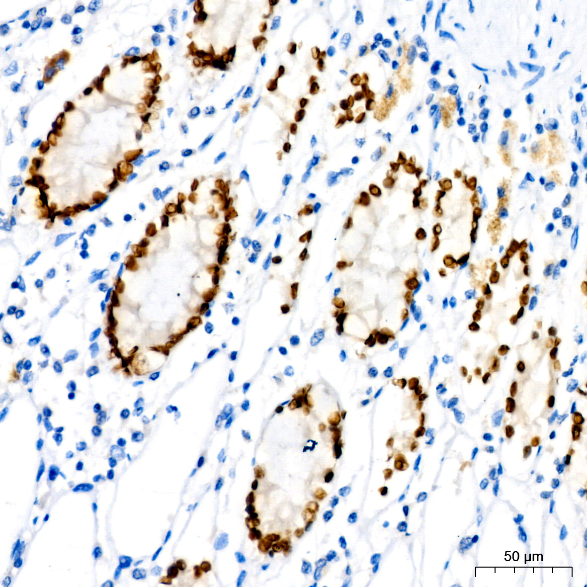SATB2 Rabbit monoclonal antibody