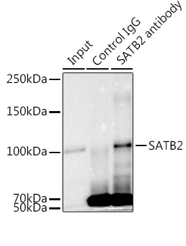 SATB2 Rabbit monoclonal antibody
