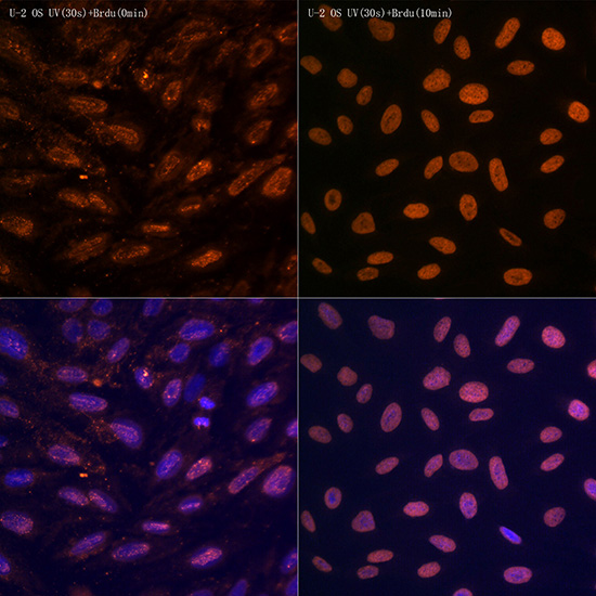 N6-methyladenosine / m6A Rabbit monoclonal antibody