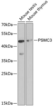 PSMC3 Rabbit polyclonal antibody