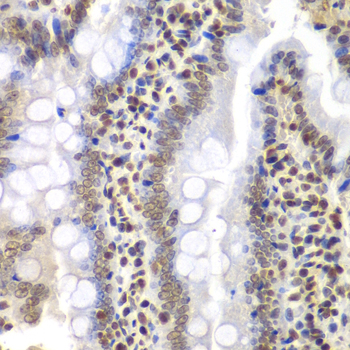 PSMC3 Rabbit polyclonal antibody