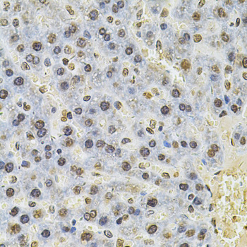 PSMC3 Rabbit polyclonal antibody