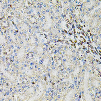PSMC3 Rabbit polyclonal antibody